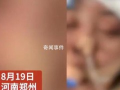 女子没给丈夫钱充手游被殴打失明 目前警方已经介入调查【图文】