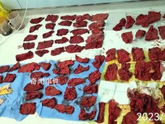 产妇大出血近8000毫升医护抢救7小时 产妇目前情况比较平稳【图文】