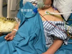 夫妻宰杀活鸭被抓伤住进ICU 俩人先后出现寒战发热的症状【图文】