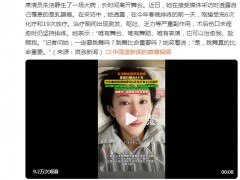 朱洁静自曝患乳腺癌 舞台舞蹈可以治愈我、救赎我
