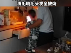 爷爷带娃玩打火机 下一秒火光冲天 脸上的皮肤也被烧伤！