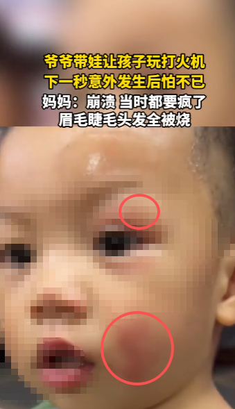 现场：爷爷带娃玩打火机 下一秒火光冲天