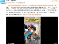 网红郭聪明剃光头发准备手术 究竟是怎么一回事?