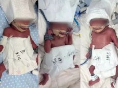 24岁女子成功诞下5胞胎 六千万分之一奇迹！（图）