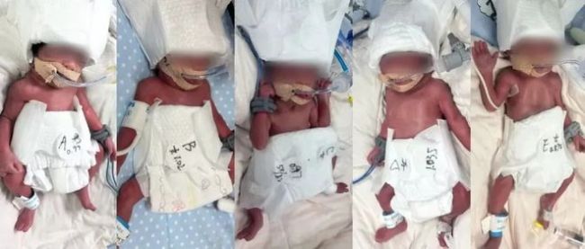 24岁女子成功诞下5胞胎