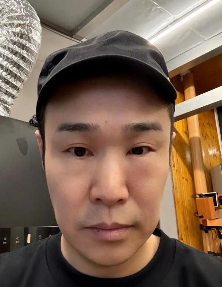 小沈阳一觉睡醒眼睛肿成蜜蜂小狗